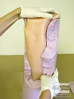 לאחר שהגומי התמצק לחלוטין אפשר להסיר מעליו את תבנית ה®Alja-Safe. תבניות אלגינט הן חד-פעמיות, מכיוון שלרוב יש לשבור אותן בכדי להוציא מהן את היציקה.