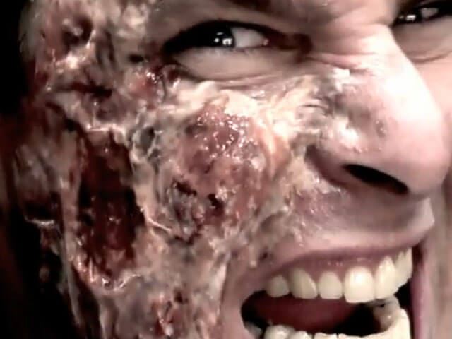 ערכות להכנת פצעים וחומר להכנת קרחות - סרמט