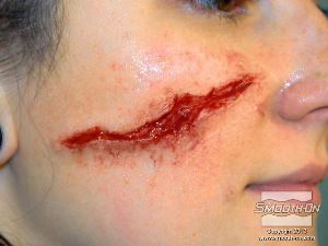 לחיצה להגדלת תמונה הצלקת הגמורה נראית וזזה כמו בשר אמיתי.