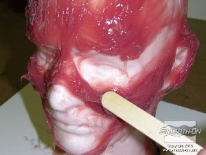 לחיצה להגדלת תמונה מורחים את שאר ה סיליקון מהיר Dragon Skin® Fast  המעובה כדי ליצור את פרטי הפנים.