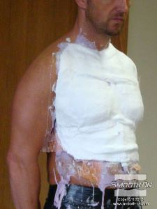 לחיצה להגדלת תמונה שמים תחבושות גבס על האלגינאט כדי להעניק לו תמיכה מבנית.