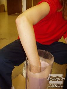 לחיצה להגדלת תמונה יש להוציא את היד בזהירות מהתבנית. הוצאה מהירה מדי של היד עלולה לקרוע את תבנית האלגינט.